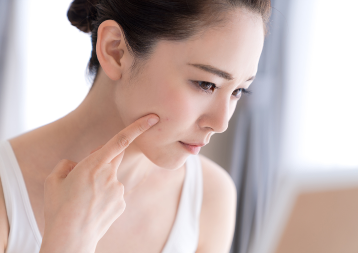 美肌を取り戻そう！たるみ毛穴の原因と改善方法の画像