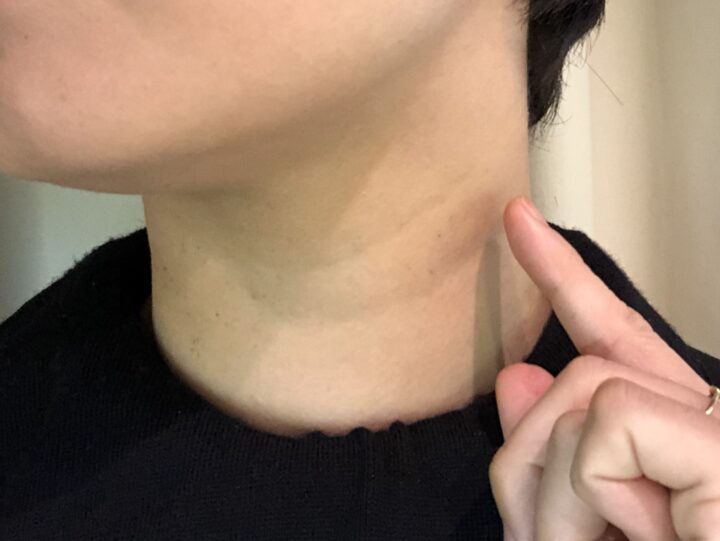 年齢が出やすい首元のしわケア✨若々しい印象を保つための美習慣｜メディカルサロンミューズの画像