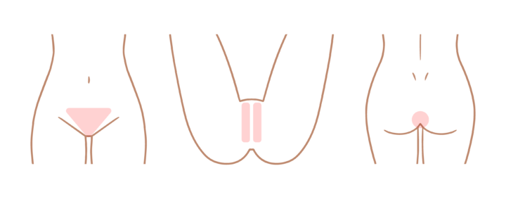 将来のために始める「介護脱毛」✨エイジングケア世代に注目される新習慣 | メディカルサロンミューズの画像